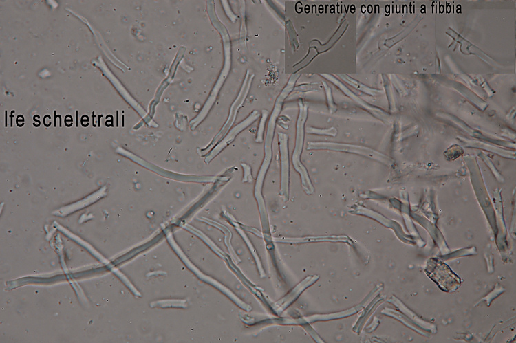 Questa  difficile... (Steccherinum sp.)
